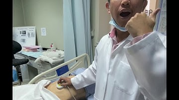 Application of Cardiotocogram