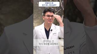 모발이식 수술 후 붓기 어느 정도일까? | 모엠의원(MOEM) | 김인성원장