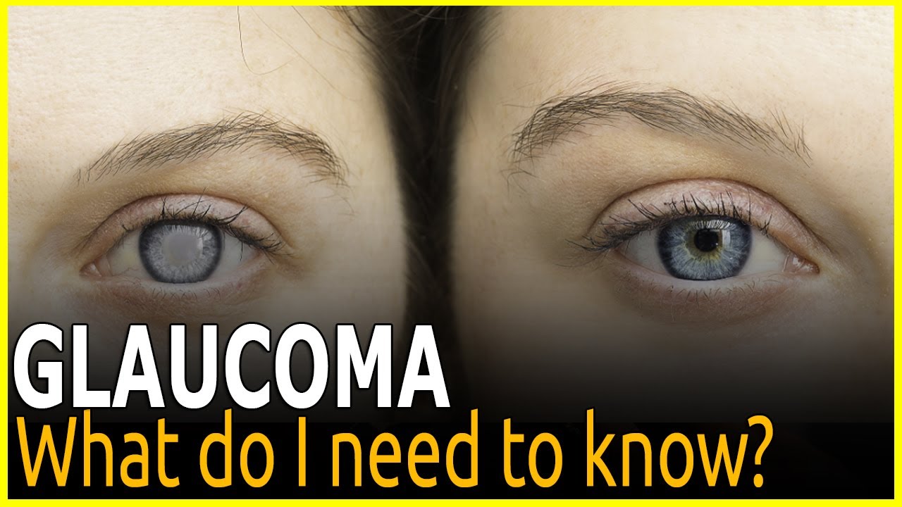 Glaucoma What’s new and what do I need to know ? #glaucoma #video # ...