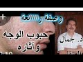 Tالوصفة السحرية  للتخلص من اتار الشيخوخة  وتجاعيد الوجه مع جمال الصقلي