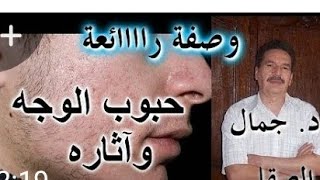 Tالوصفة السحرية  للتخلص من اتار الشيخوخة  وتجاعيد الوجه مع جمال الصقلي