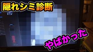 隠れシミ診断してもらったらやばかった！