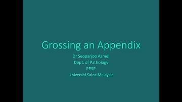 Grossing an appendix