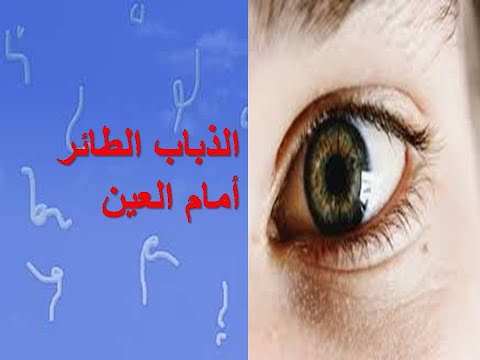 الذباب الطائر و رؤية الخيوط في العين كل ما يتعلق بهذه الظاهرة و خطورتها