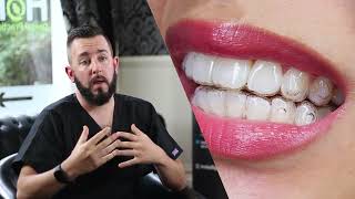 How Invisalign changes your face