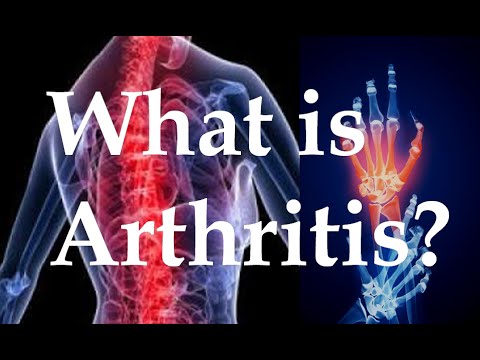 What is arthritis