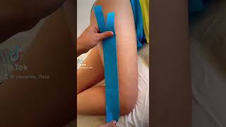 Kinesiotaping Para Banda Iliotibial.