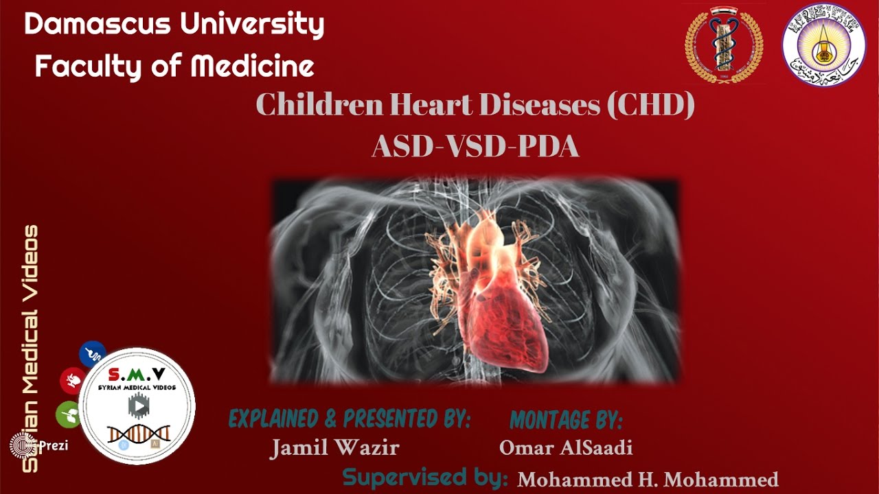 التشوهات القلبية الولادية غير المزرقة (ASD- VSD- PDA) - جامعة دمشق - S.M.V