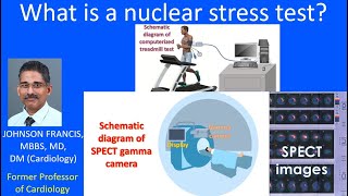 What is a nuclear stress test?