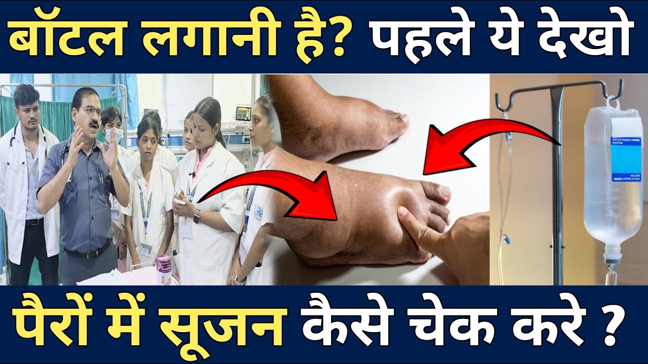 IV Fluid (बॉटल) लगाने से पहले ये clinical sign ज़रूर चेक   करे, नजरअंदाज किया तो होगा बड़ा नुकसान |