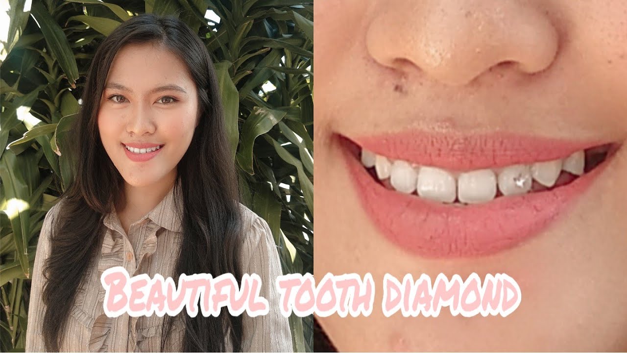 TOOTH DIAMOND PASANG BERLIAN DI GIGI YouTube