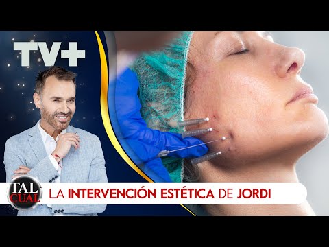 La intervención estética de Jordi