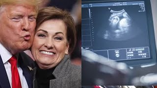 Abortion Rights Take Brutal Blow In Iowa