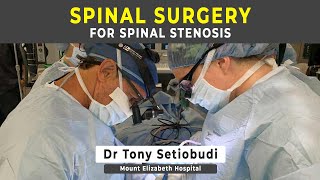 SURGERY FOR SPINAL STENOSIS
