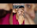 Shaving My Face For Instant Smooth Skin | Shaving face hair women | Macro Face Shaving #shorts