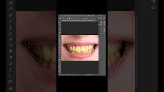 HOW TO WHITEN TEETH IN PHOTOSHOP | QUICK TUTORIAL #adobephotoshop #photoshoptutorial screenshot 5