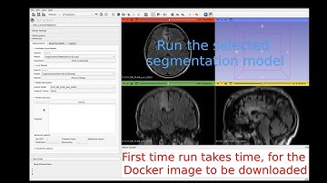 Raidionics plugin installation in 3DSlicer