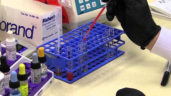 Blood Bank - ABO Rh