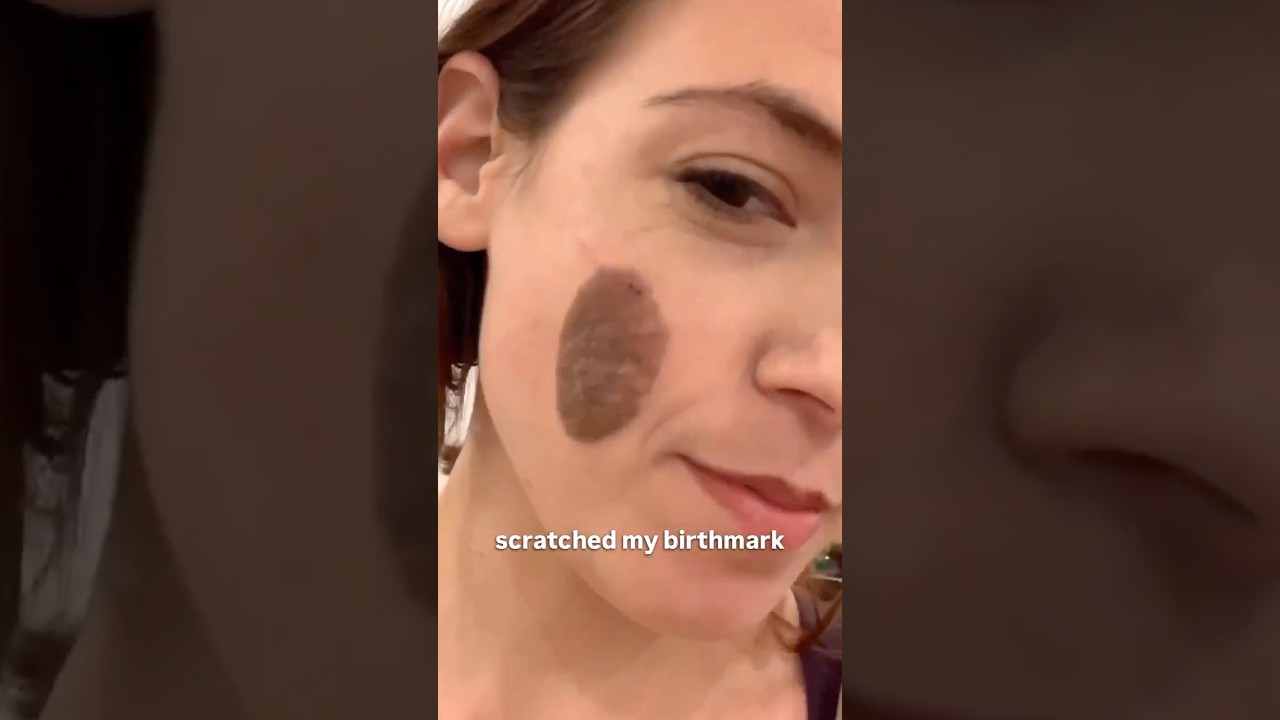 Would you have said anything? #jokes #standupcomedy #weird #cat #birthmark #mole