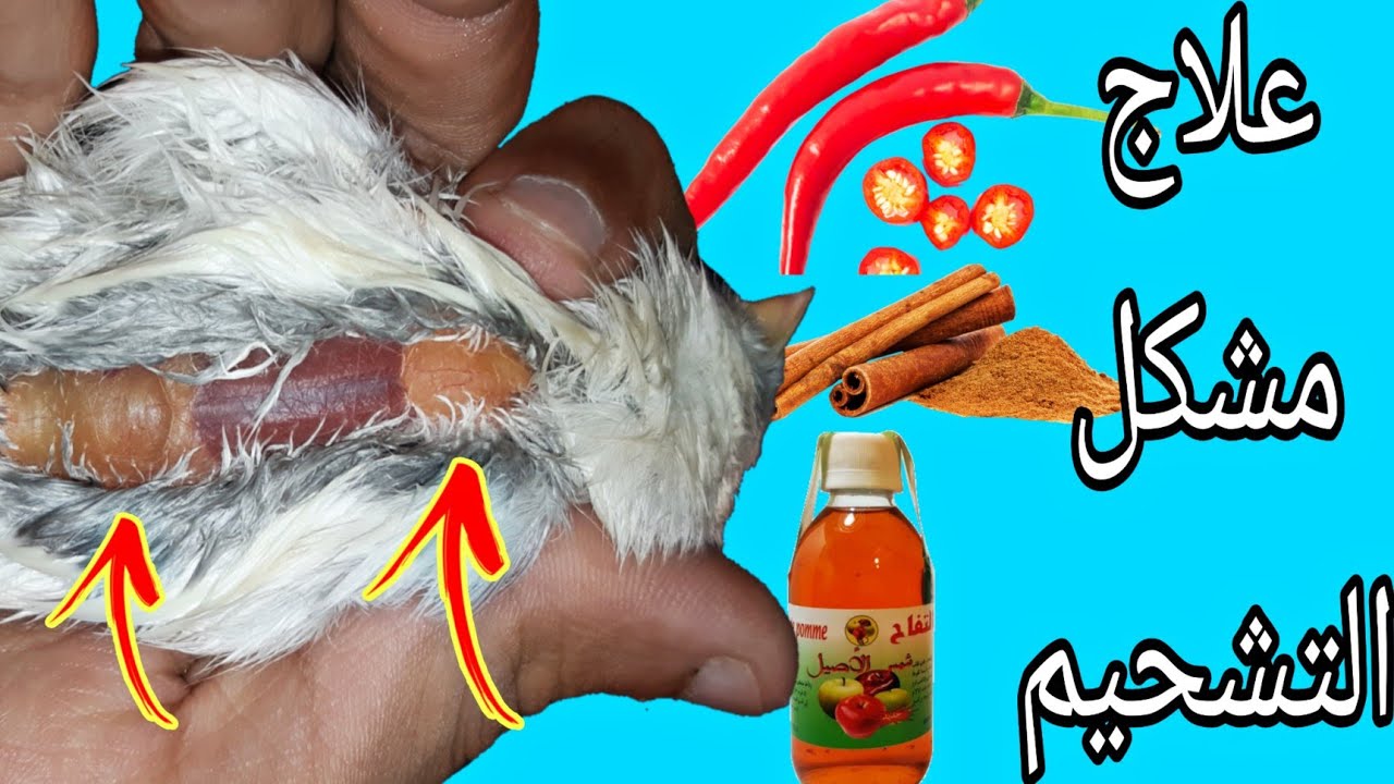 علاج مشكل التشحيم بطريقة سهلة و في مدة قصيرة | القرفة|