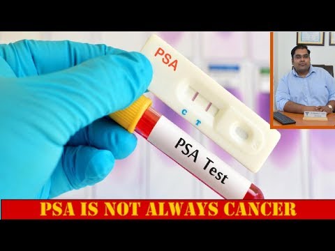 Video: Wat is die betekenis van PPSA?
