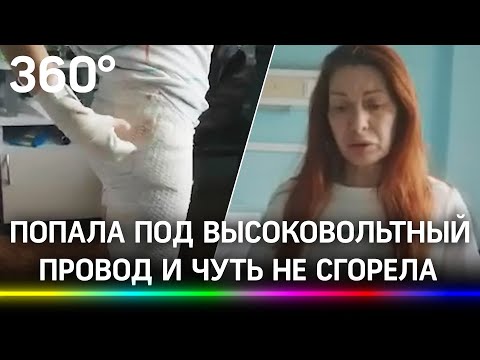 «Её трясло, одежда расплавилась: москвичка чуть не сгорела заживо из-за оборвавшейся ЛЭП