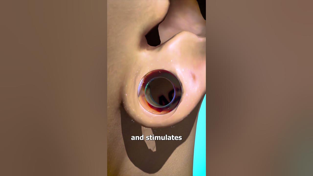 How Ear Gauges Can Tear Your Ears 👂