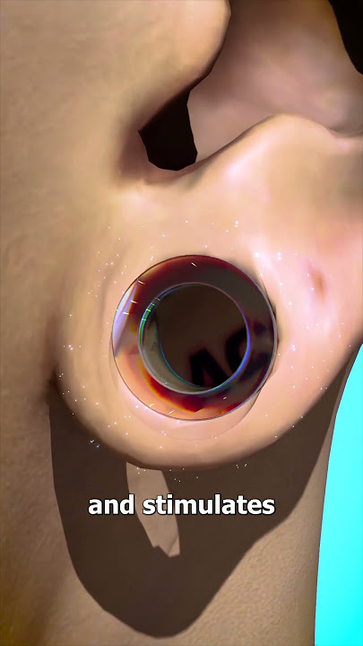 How Ear Gauges Can Tear Your Ears 👂