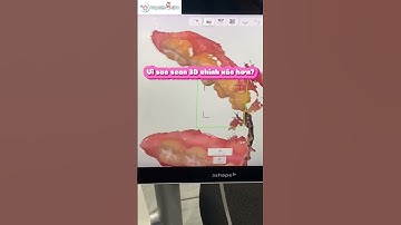 Lấy Dấu Răng Bằng Máy Scan 3D – Nhanh, Nhẹ, Và Chính Xác? | Nha Khoa MARINA #nhakhoamarina #dentist