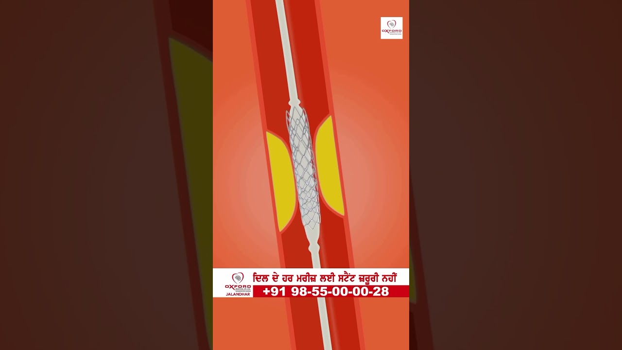 Heart Blockage Treatment Without Angioplasty In Jalandhar, Punjab