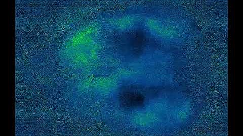 Calcium activity waves play across dorsal cortex