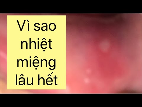 cách vệ sinh răng miệng cho trẻ tại Kemtrinam.vn