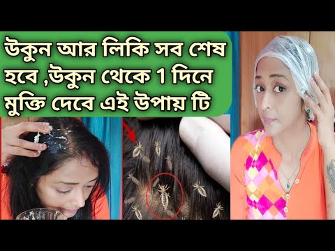 ভিডিও: মশা ধরার 3 টি উপায়