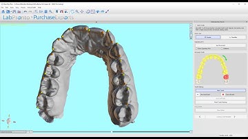 BlueSkyPlan v4.8.2.3: Clear Aligner Workflow - Step2: TeethMarking