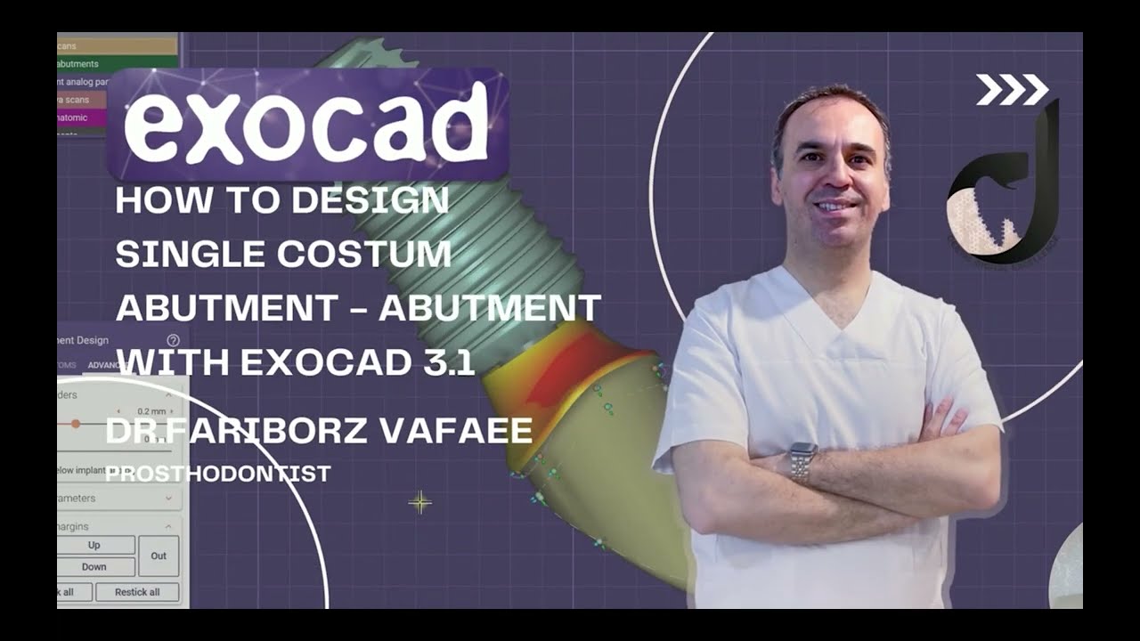 how to design custom abutment with exocad3.1 (part2)
