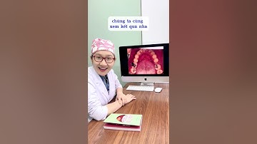 Bị mất răng số 6 thì có niềng để kéo đóng cái răng số 7 lại được không? #shorts