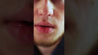 Явные и скрытые признаки болезни почек Опасные симптомы  #здоровыерецепты #почки #здоровье