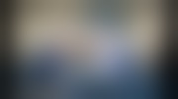 The 7 steps to perform a robotic nerve sparing radical prostatectomy