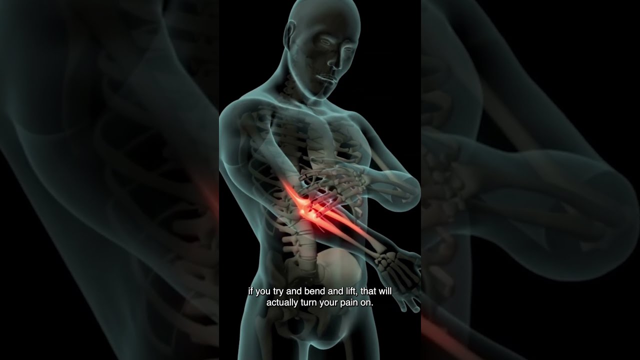 Are Brachioradilais Trigger Points Causing Your Wrist And Elbow Pain 
