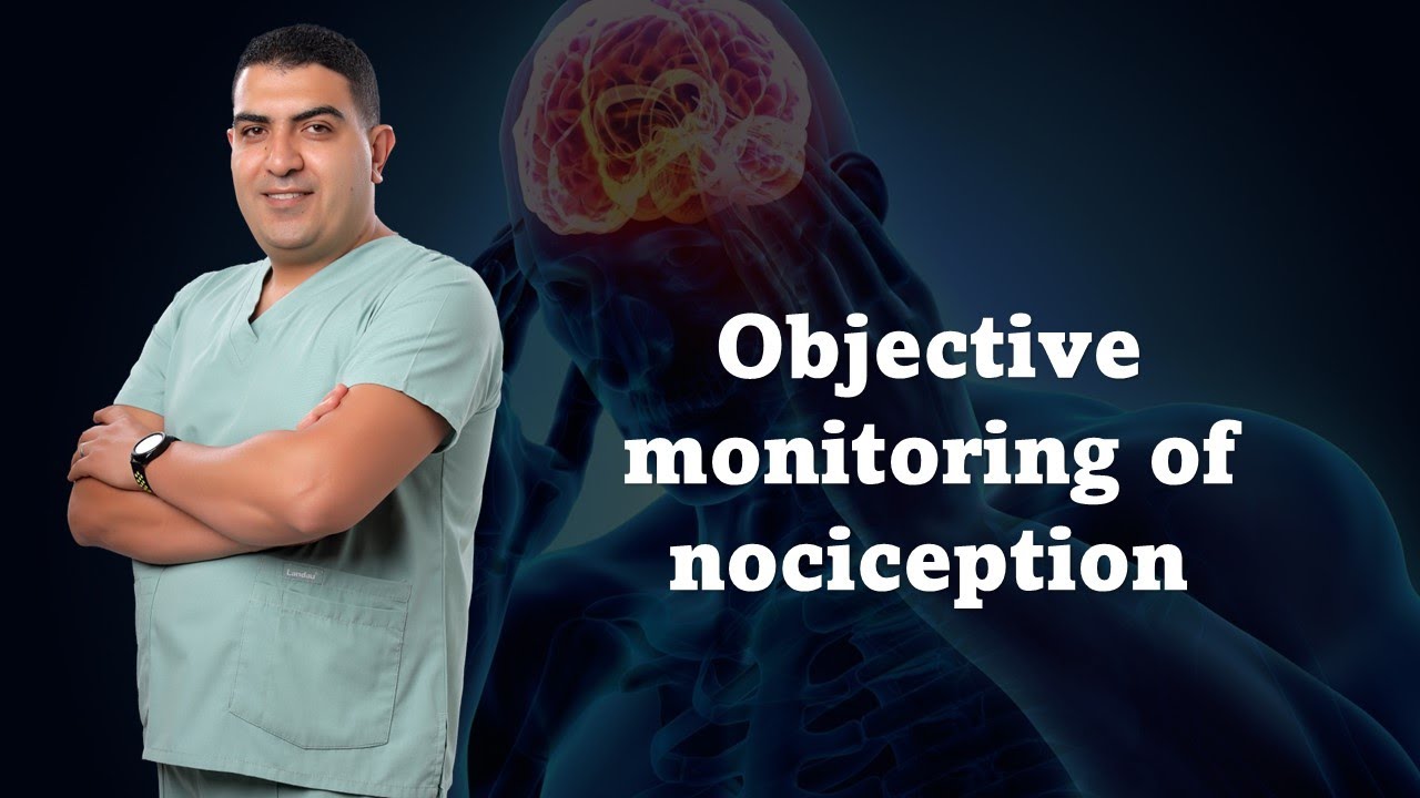 Objective monitoring of nociception