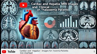 Cardiac and Hepatic (T2*) MRI Images and Clinical Dataset for Iron Overload on Thalassemia Patients