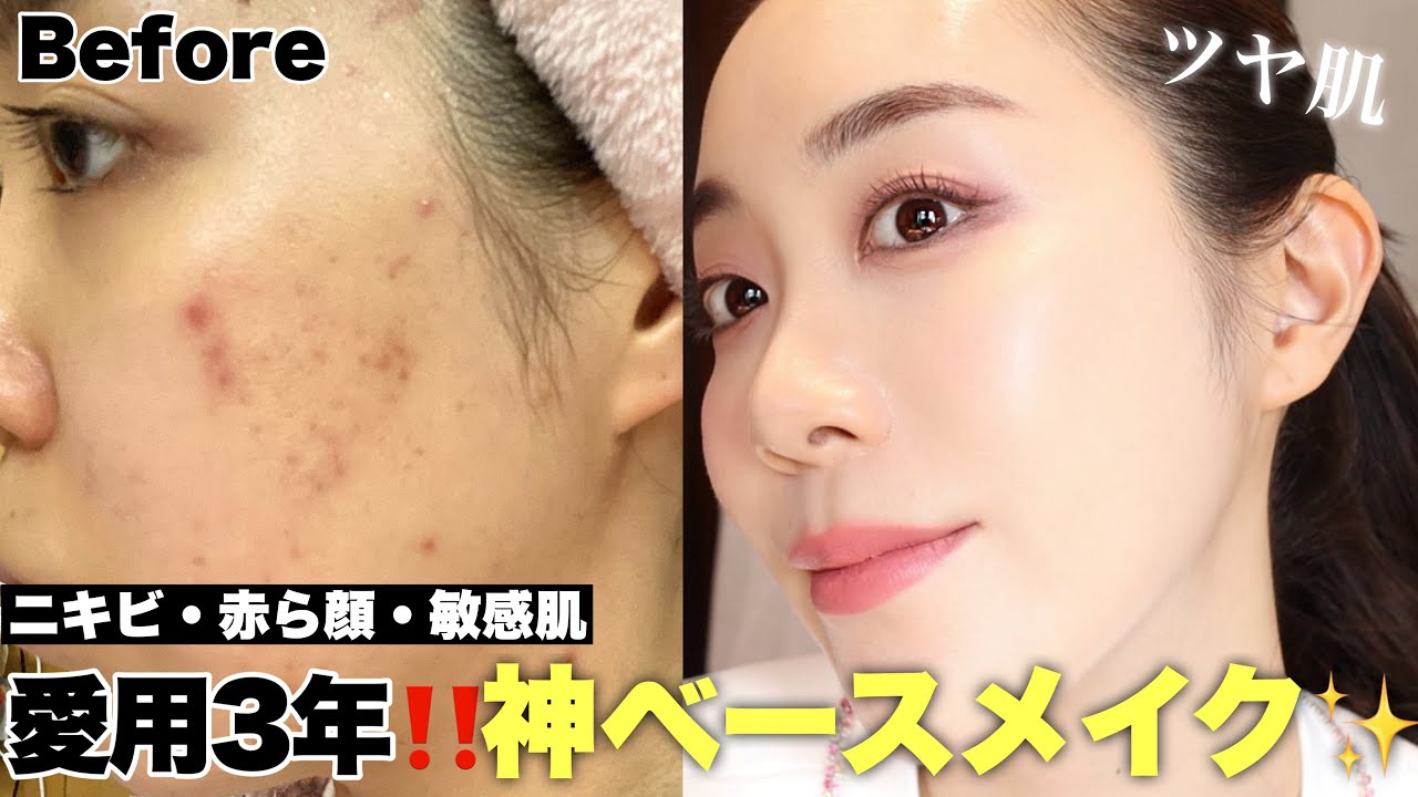 CC] My Favorite Base Makeup I Had Kept Using for My Rough/Acne