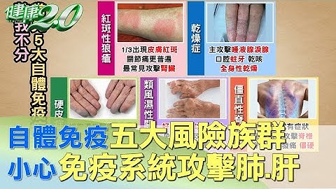 自体免疫五大风险族群 小心免疫系统攻击肺、肝 健康2.0 - 天天要闻