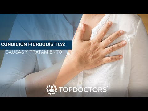 Vídeo: Enfermedad Fibroquística De La Mama: Causas, Síntomas Y Diagnóstico