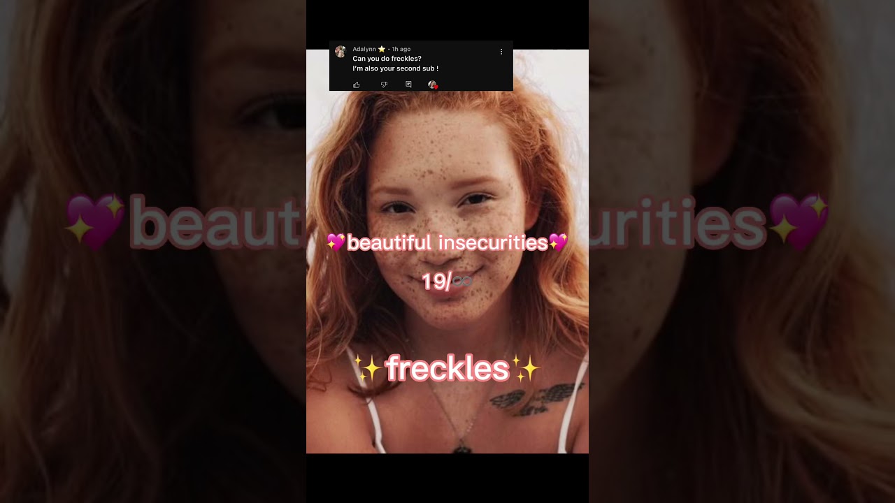 beautiful insecurities~ freckles 💄 19/♾️