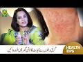Pani Ki Kami Se Kaise Bachain? | Healthy Hydration Tips | Dr. Batool Ashraf | Masala TV
