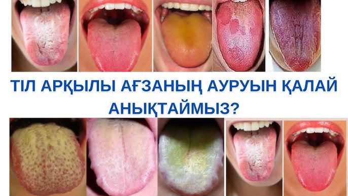 Анальды секс фотосуреттері Жас келіншектердің алдау порно көруі