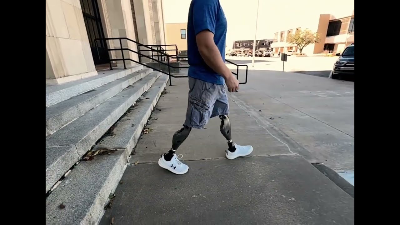 Genium X4 Microprocessor Knee Bilateral Users