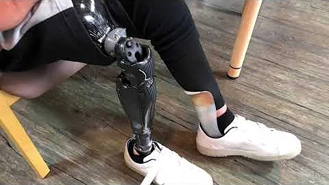 Prosthetic knee joint Walking with ALLUX2