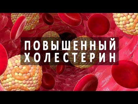 10 признаков | ХОЛЕСТЕРИНА | повышенного